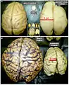 Various brains. Clockwise from top left: Adult rhesus; Adult mouse; Midgestation human; Newborn human; Adult human.
